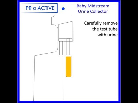 how to collect baby urine sample